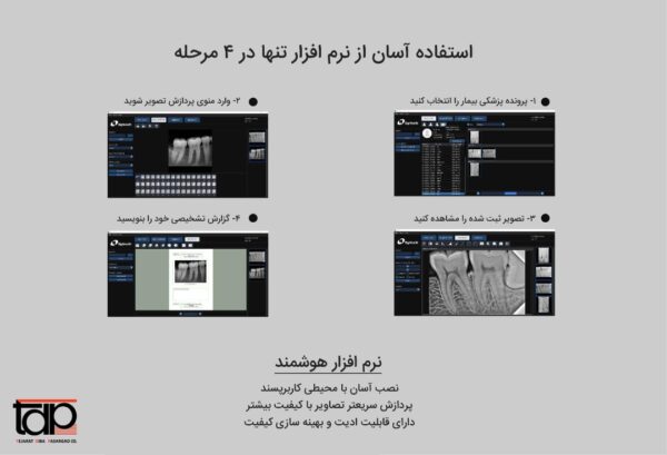 سنسور رادیوگرافی Eighteeth - NanoPix - Image 6