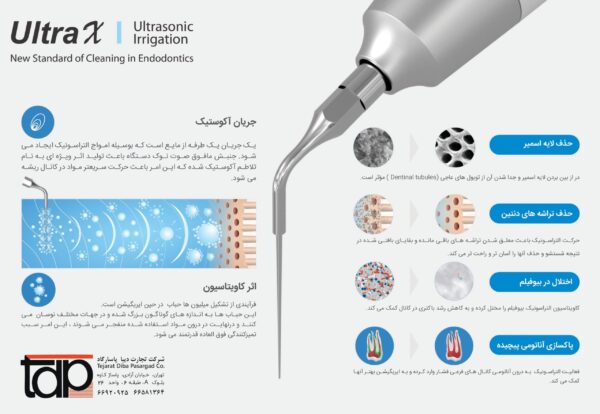 اولتراسونیک ایریگیشن Eighteeth - Ultra X - Image 2